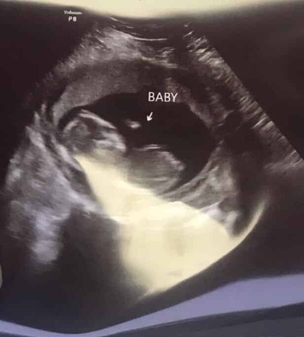 Baby Girl photo