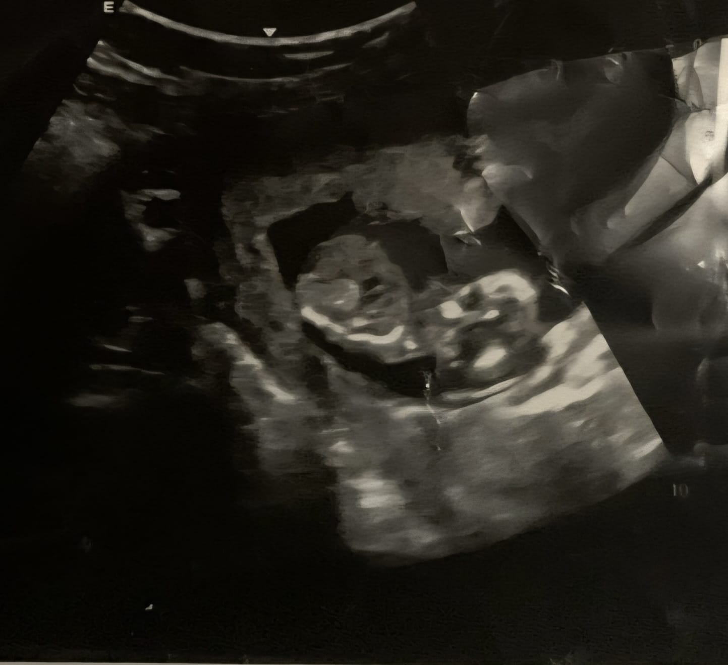 Baby Mueting photo